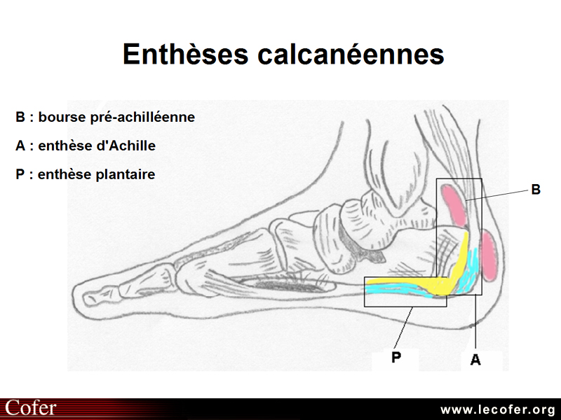 Enthésopathies / enthésites : Schéma des enthèses calcanéennes