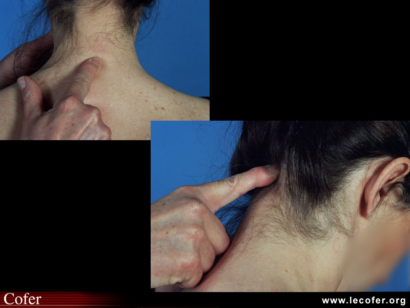 Palpation interépineuse et cervico-occipitale