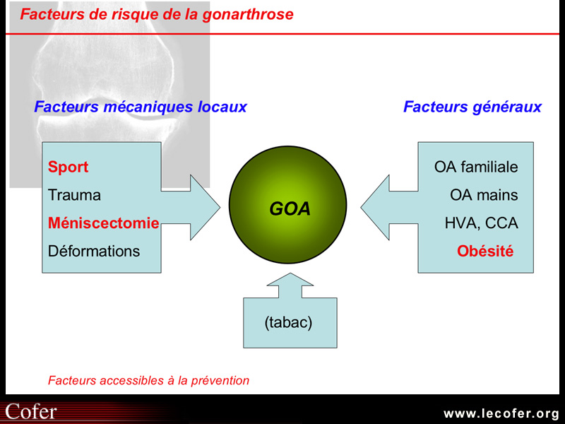 Physiopathologie de l'arthrose : facteurs étiologiques