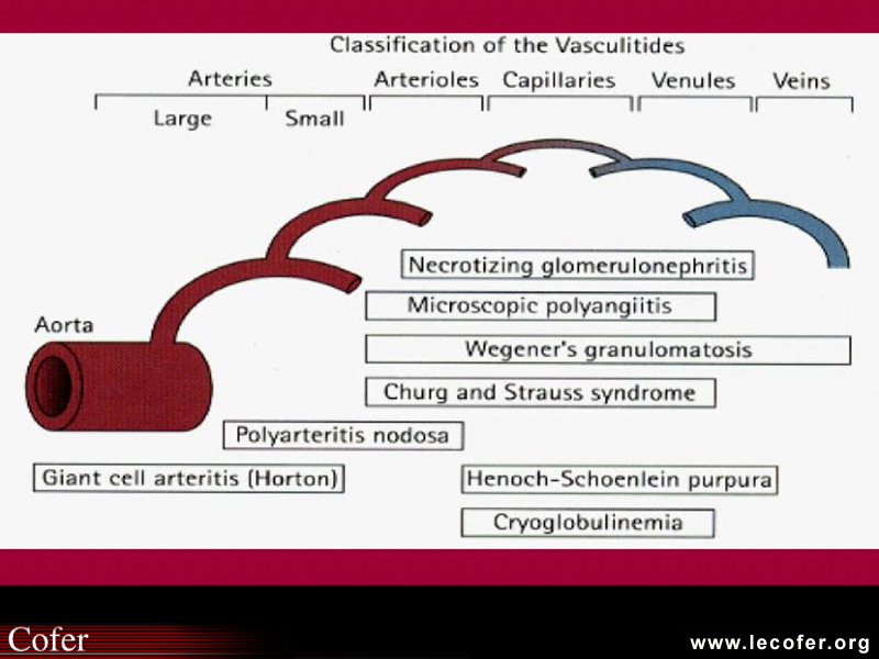 Vascularites, classification selon la taille des vaisseaux