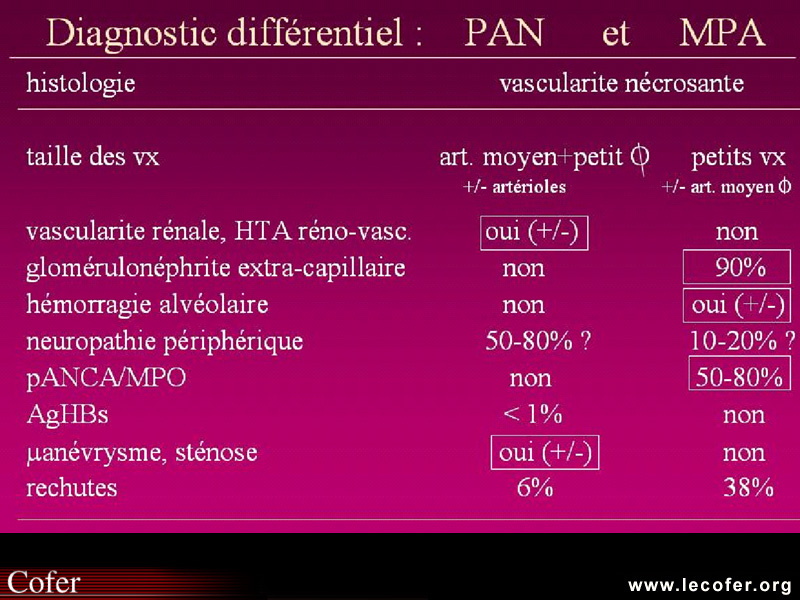 Vascularite, diagnostic différentiel entre périartérite noueuse et micropolyangéite