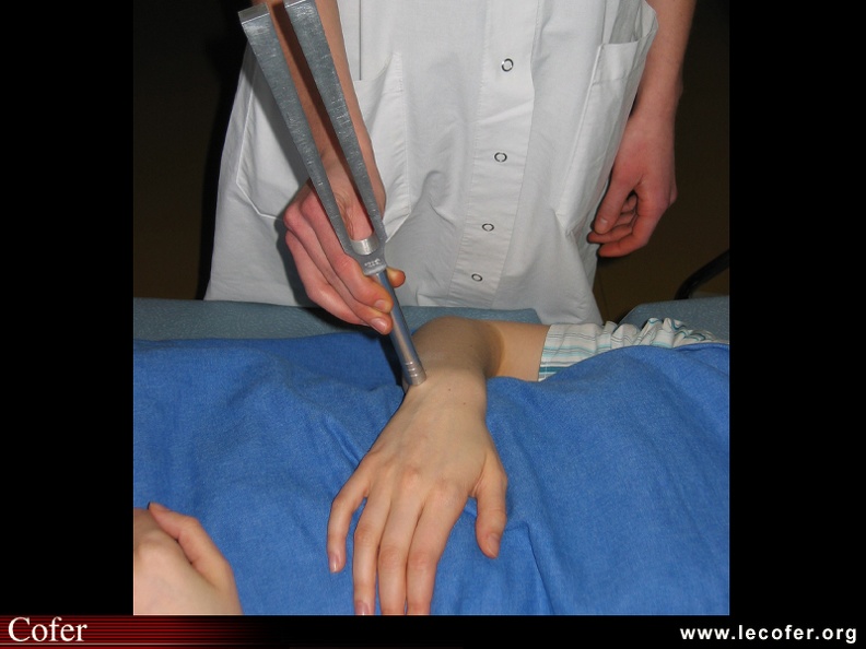 Polyarthrite rhumatoïde – PR établie ; atteinte rachis cervical ; sensibilité osseuse au diapason ; placer la tige du diapason sur une surface osseuse (radius, ulna) et demander au patient de vous dire s'il sent la vibration. 0201010065.jpg