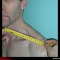 Mesure de la distance menton-acromion chez un patient SpA en rotation maximale