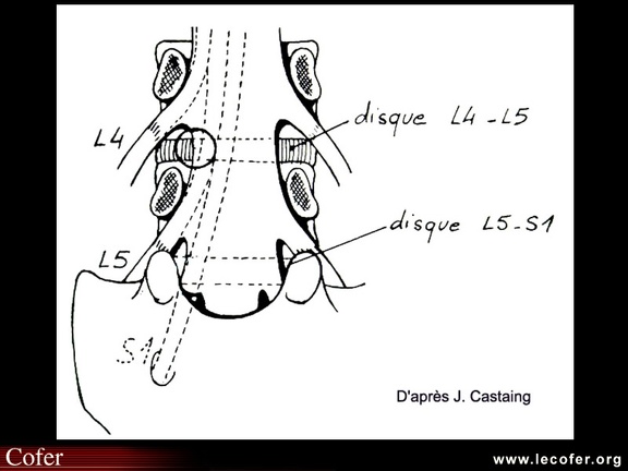 Anatomie lombo-radiculaire