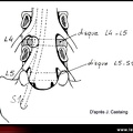 Anatomie lombo-radiculaire