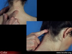 Palpation interépineuse et cervico-occipitale