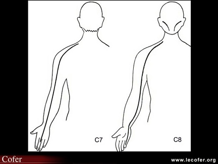 Sensibilité C7 et C8