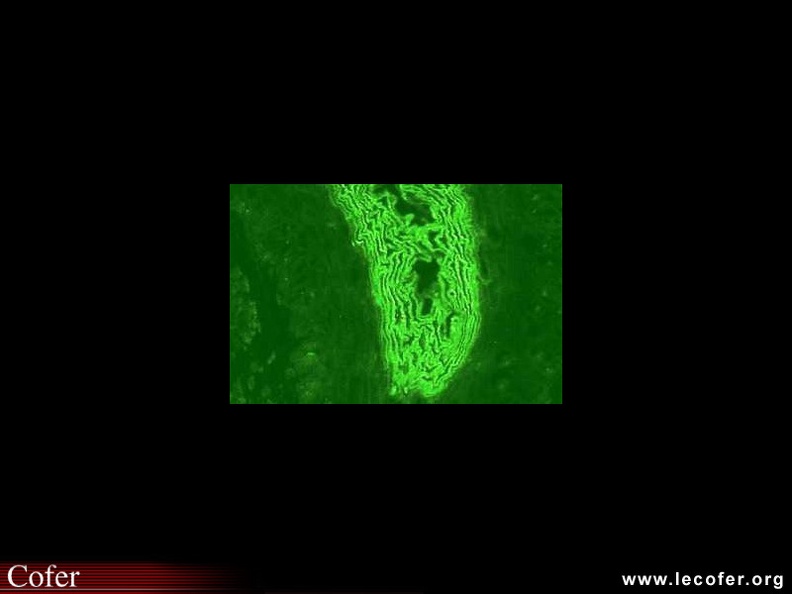 Anticorps Anti-Kératine (AKA) sur coupe d'œsophage de rat. Fluorescence en millefeuilles des couches superficielles de l'épithélium kératinisé de la muqueuse œsophagienne. 010102002.jpg