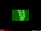 Anti-kératine immunofluorescence