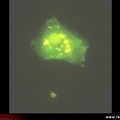 Anticorps anti-périnucléaires, APN immunofluorescence