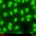 Anticorps AntiNucléaires : AAN sur Hep-2 : AAN moucheté immunofluorescence