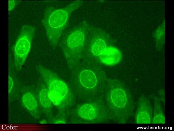 Anticorps AntiNucléaires : AAN sur Hep-2 : AAN périphérique immunofluorescence