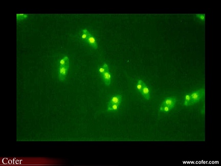 Anticorps AntiNucléaires : AAN sur Hep-2 : ADN natif sur Crithidia luciliae