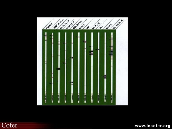 Tracés de Western blot pour anticorps anti-antigènes nucléaires solubles