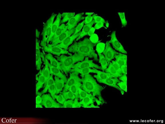 Anticytoplasme sur Hep-2  : anti-ribosomes