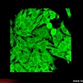 Anticytoplasme sur Hep-2  : anti-ribosomes