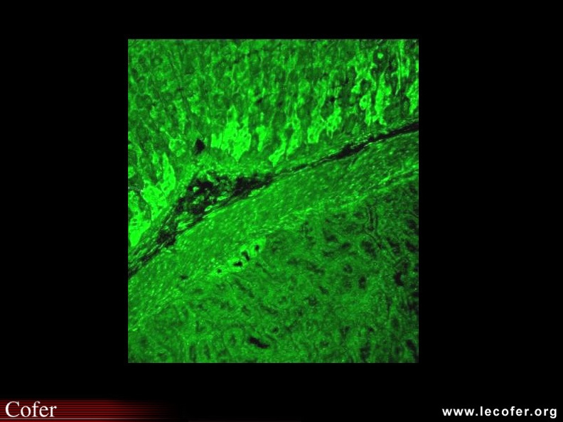 Anticytoplasme sur triple substrat : anti-ribosomes