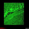 Anticytoplasme sur triple substrat : anti-ribosomes