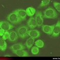 Anticorps sur anti-JO1 : immunofluorescence sur hep-2