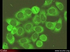Anticorps sur anti-JO1 : immunofluorescence sur hep-2