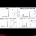 Intégrations densitométriques d’électrophorèses normale et pathologiques