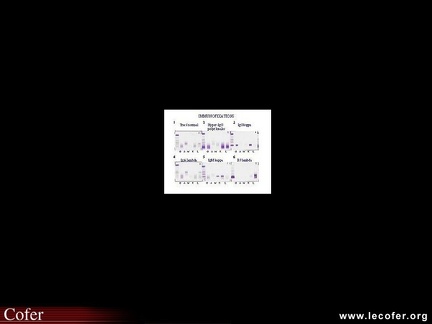 Immunofixation des protéines sériques