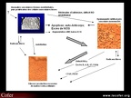 Sclérodermie systémique / atteinte vasculaire périphérique de la sclérodermie systémique