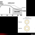 Ostéoporose, mécanismes physiopathologiques : évolution de la masse osseuse avec l’âge