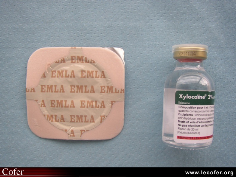 On peut obtenir une anesthésie :
- de contact soit par gel (immédiat), soit par pulvérisation (immédiat), soit par pommade (1 heure de délai avant action) pour les anesthésies superficielles (3 mm de profondeur),
- par injection intradermique, ou sous-cutanée et profonde, le plus souvent par lidocaïne non adrénalinée. 120001004.jpg
