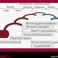 Vascularites, classification selon la taille des vaisseaux