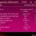 Vascularite, diagnostic différentiel entre périartérite noueuse et micropolyangéite