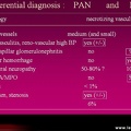 Vascularites : diagnostic différentiel entre périartérite noueuse et micropolyangéite