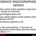 Définition des incidences radiographiques