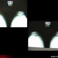 Radiographies normales de l’articulation fémoro-patellaire en défilé