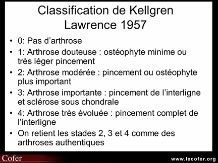 Gonarthrose : la classification de Kellgren et Lawrence