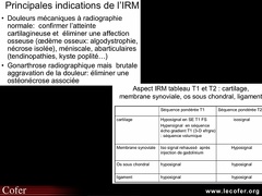 Principaux aspects IRM et principales indications dans la gonarthrose
