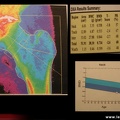 Ostéoporose : mesure de la densité minérale osseuse du fémur
