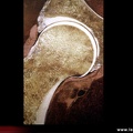 Coupe anatomique de la hanche